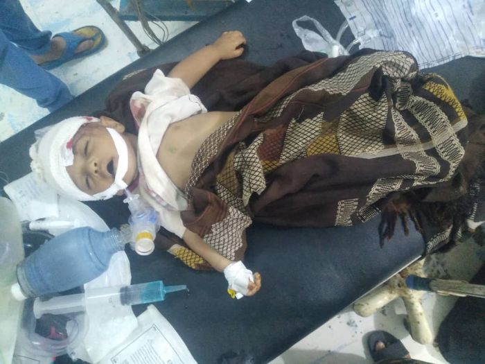 وفاة طفل متأثرًا بجراحه جراء قصف حوثي غربي تعز
