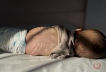 وفاة الآلاف.. واقع الاطفال والأجنة المأساوي في قطاع غزة منذ بدء الحرب