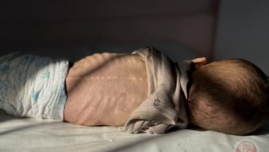 وفاة الآلاف.. واقع الاطفال والأجنة المأساوي في قطاع غزة منذ بدء الحرب