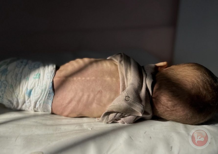 وفاة الآلاف.. واقع الاطفال والأجنة المأساوي في قطاع غزة منذ بدء الحرب