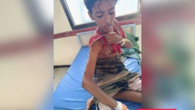 إصابة طفل برصاص قناص حوثي في لحج
