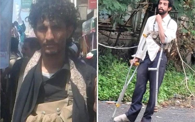 مجلس المقاومة الشعبية بتعز: استشهاد مقاتلَين مُعاقَين في جبهة كلابة "رسالة صمود وعزّة "