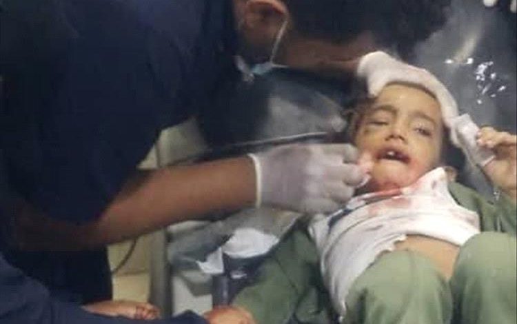مدير عام مستشفى كرى العام يطمئن على صحة الطفلة الناجية من حادث السير المروّع الذي أودى بحياة 14 راكباً