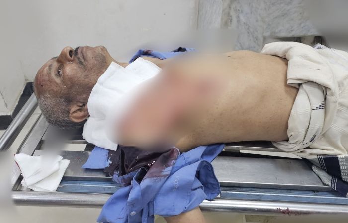 تعز.. قناص حوثي يصيب مواطنًا قرب منزله