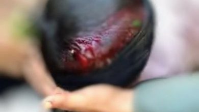 في جريمة صادمة.. مقتل طفل برصاص مسلح في ذمار