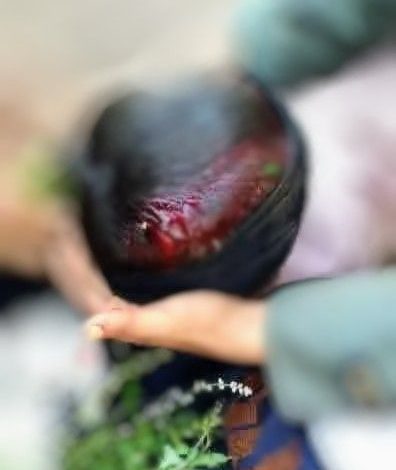 في جريمة صادمة.. مقتل طفل برصاص مسلح في ذمار