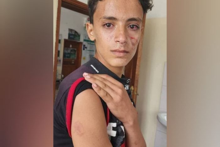 مشرف حوثي يعتدي على أسرة في ريمة ويتسبب بإصابة طفل وفقدان والدته لجنينها