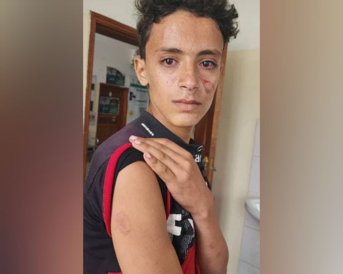 مشرف حوثي يعتدي على أسرة في ريمة ويتسبب بإصابة طفل وفقدان والدته لجنينها