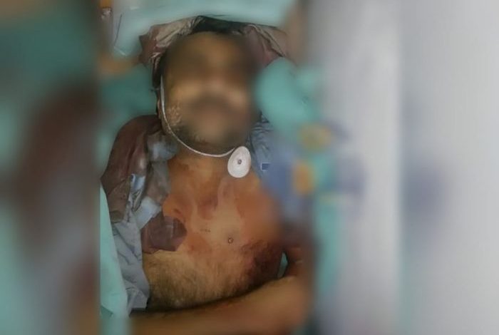 منظمة حقوقية: مليشيا الحوثي تواصل احتجاز جثمان تربوي توفي تحت التعذيب في سجونها منذ 2016