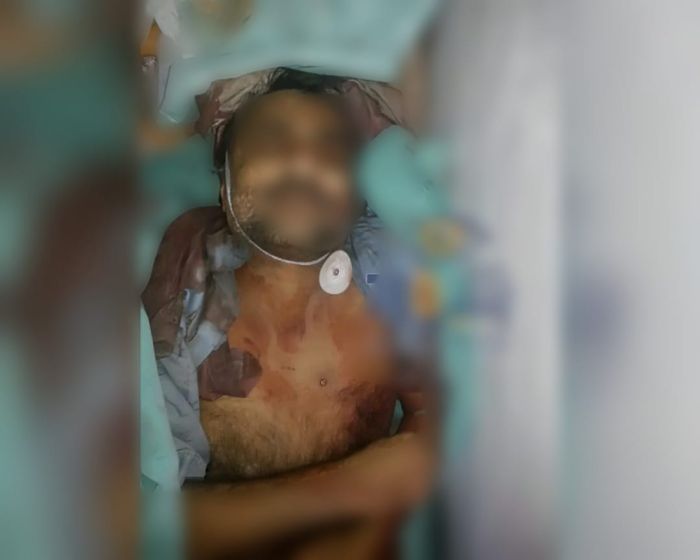 منظمة حقوقية: مليشيا الحوثي تواصل احتجاز جثمان تربوي توفي تحت التعذيب في سجونها منذ 2016