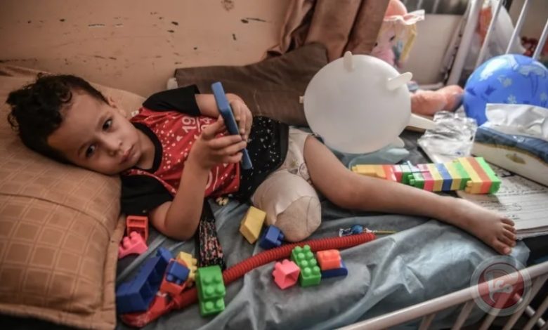 غزة تسجّل أعلى معدل لبتر الأطراف لدى الأطفال نسبةً لعدد السكان عالمياً