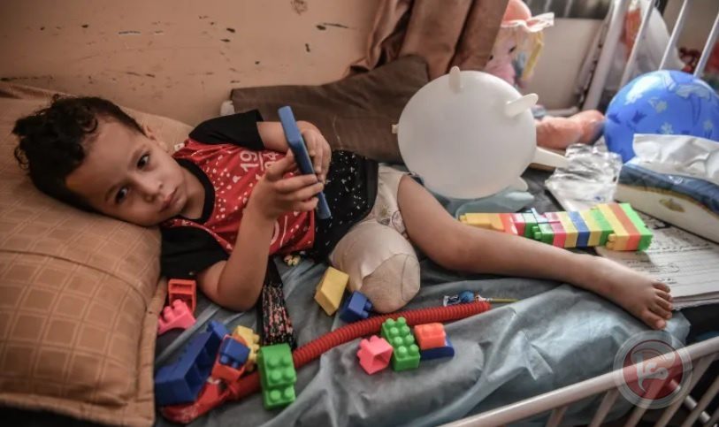 غزة تسجّل أعلى معدل لبتر الأطراف لدى الأطفال نسبةً لعدد السكان عالمياً