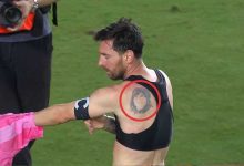 طبيب بلجيكي يطمئن لامين يامال