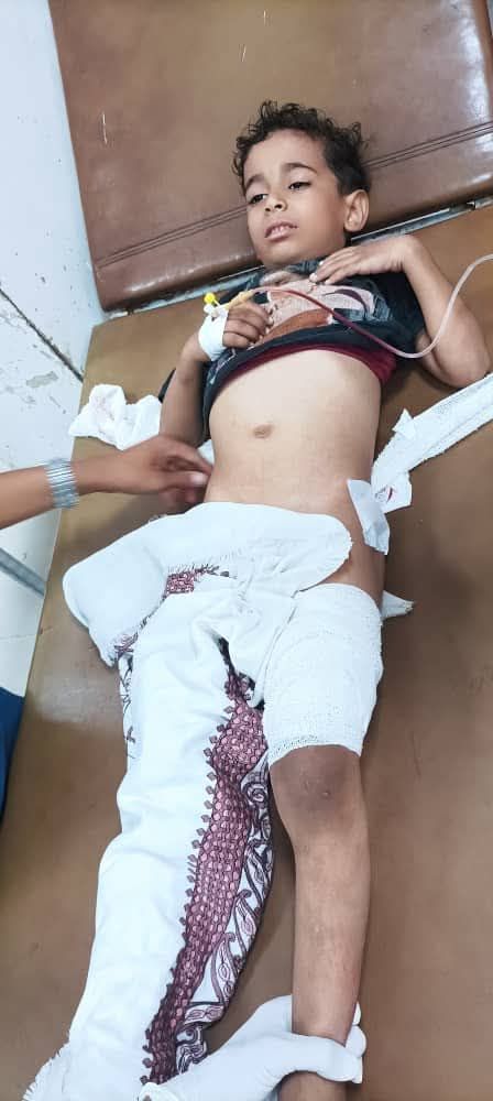 إصابة طفل برصاص قناص حوثي في مدينة تعز