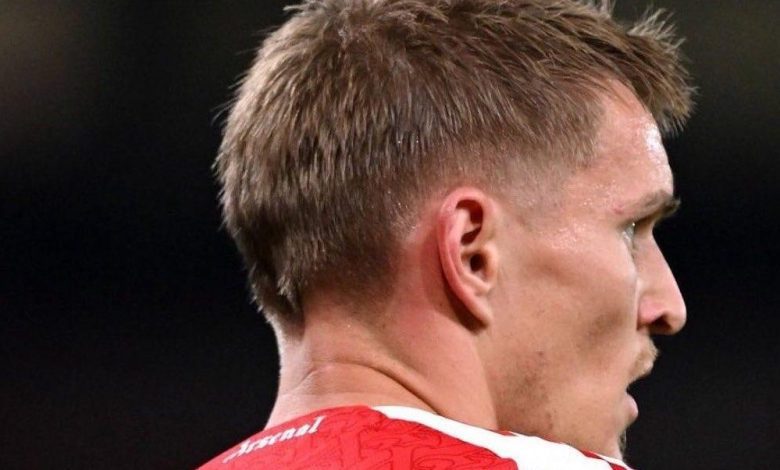 أوديجارد يكشف آخر تطورات إصابته