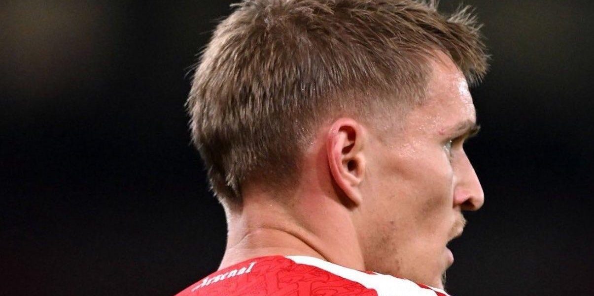 أوديجارد يكشف آخر تطورات إصابته