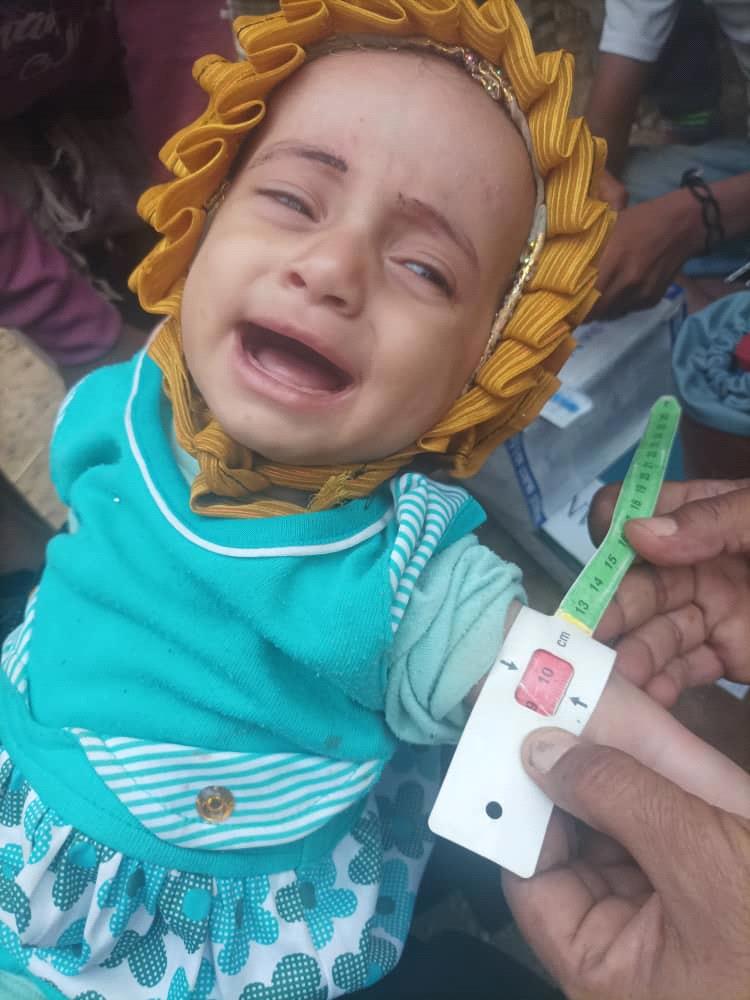 تصريحات صادمة لمدير وحدة حُلحال بالضالع: نداء استغاثة عاجل لإنقاذ آلاف المرضى في "أفقر الوحدات الصحية"