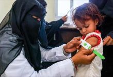 تقرير أممي: تفاقم سوء التغذية بين أطفال اليمن وارتفاع معدلات الفقر الغذائي