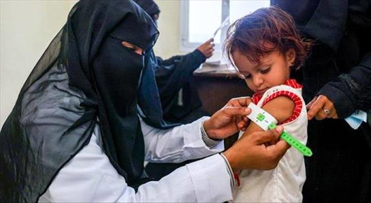 تقرير أممي: تفاقم سوء التغذية بين أطفال اليمن وارتفاع معدلات الفقر الغذائي