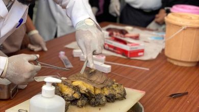 كلية الطب بجامعة عدن تحتفي باليوم العالمي للأمراض بفعالية توعوية مميزة