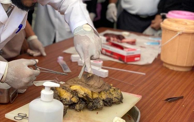 كلية الطب بجامعة عدن تحتفي باليوم العالمي للأمراض بفعالية توعوية مميزة