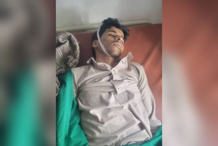 غموض يحيط بوفاة طفل في مركز أمني لمليشيا الحوثي بحجة