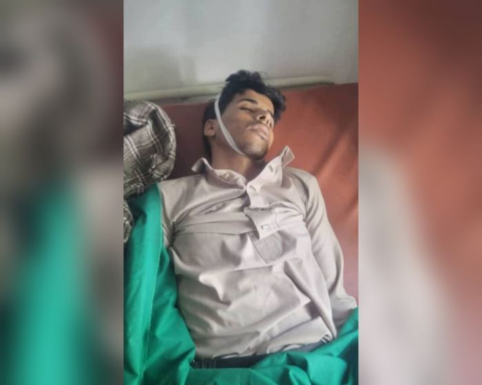 غموض يحيط بوفاة طفل في مركز أمني لمليشيا الحوثي بحجة