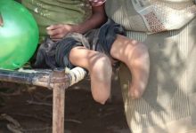 في يومهم العالمي.. أطفال الحديدة ضحايا الإرهاب الحوثي