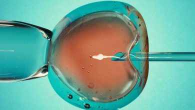 هبوط اضطراري لطائرة فوق سيارة على الطريق السريع في فلوريدا (فيديو)