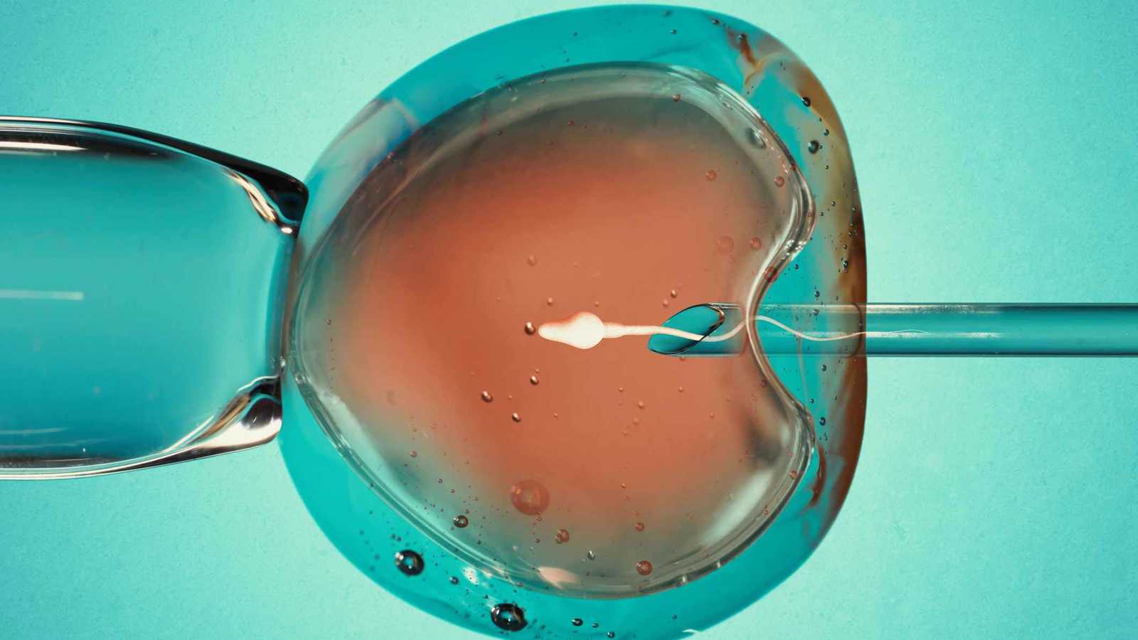 هبوط اضطراري لطائرة فوق سيارة على الطريق السريع في فلوريدا (فيديو)