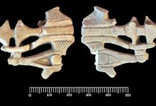 رجل يقاضي زوجته بعد رفضها التبرع له بجزء من كبدها