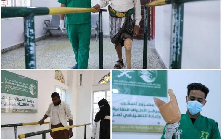 مركز الأطراف الصناعية في تعز يُقدم خدماته لـ(564) مستفيدًا خلال نوفمبر الماضي