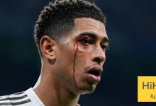 ثلاثي ريال مدريد يعانون من انزعاجات