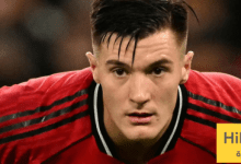 نجم اليونايتد يسابق الزمن للحاق بمباراة بورنموث