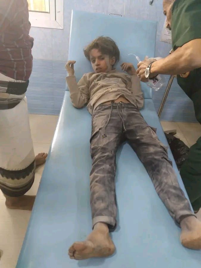 تعز.. إصابة طفل وفتاة في قصف حوثي على الأحياء السكنية شرقي المدينة