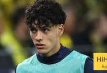 صورة .. كتف هيكتور فورت بعد خضوعه للعملية الجراحية