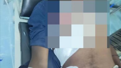 إصابة مدني بقصف حو_ثي استهدف مخيمًا للنازحين جنوب الحديدة