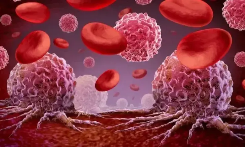 المعهد القومي للأورام في مصر يحذر من علاجات بديلة ترفع خطر الوفاة بمرض السرطان 2.5 مرة