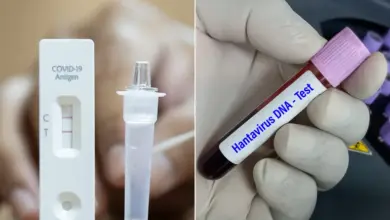 الفروق الجوهرية بين هانتا وكوفيد-19.. طرق العدوى والانتشار ودرجات الخطورة