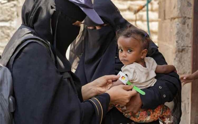تقارير أممية: أطفال اليمن بين الجوع والألغام والحرمان من التعليم