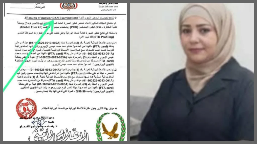 ميرا والبيان الحوثي