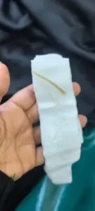 ”شوكة سمك تُرعب عدن.. فتاة تُنقذ من الموت في اللحظات الأخيرة”