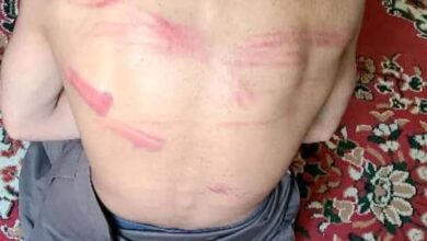 قيادي حوثي يشرف على تعذيب طفل «14 عاما» بصورة بشعة في أحد المعتقلات بضحيان صعدة