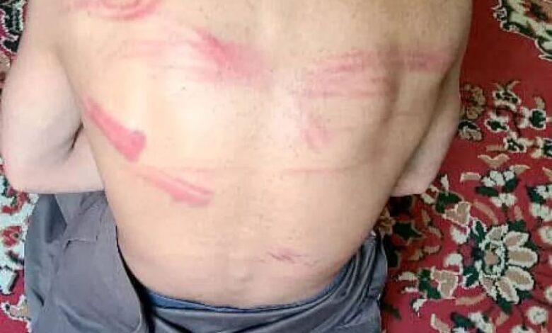 قيادي حوثي يشرف على تعذيب طفل «14 عاما» بصورة بشعة في أحد المعتقلات بضحيان صعدة