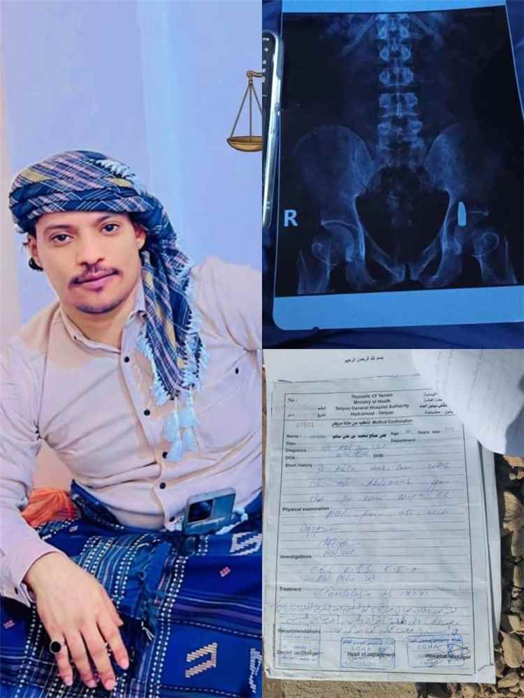 متهم محتجز بسيئون منذ أكثر من عام يطالب بالإفراج
