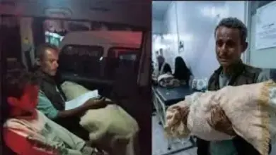 وفاة الطفلة صفية في تعز تُشعل غضباً شعبياً واتهامات بالتقصير الطبي
