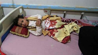 تقرير رسمي: نحو 17 ألف إصابة بالحصبة وأكثر من 100 وفاة في مناطق الحكومة خلال 2025