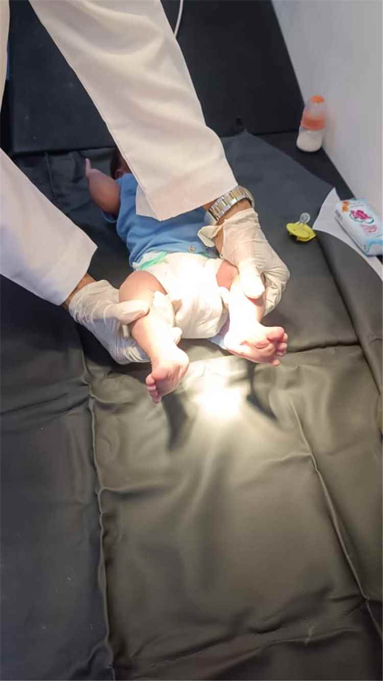 مدير الأطراف الصناعية بعدن يكشف عن قيام المركز بإجراء عملية تشوه خلقي بنجاح