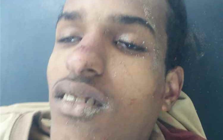 مقتل شاب برصاص مسلح في سوق المحلة بمحافظة لحج