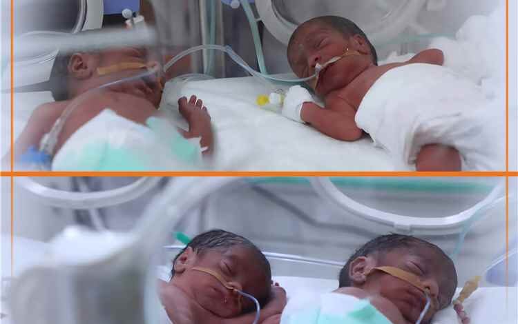 ولادة نادرة لأربعة توائم في مأرب والأم والمواليد بصحة جيدة